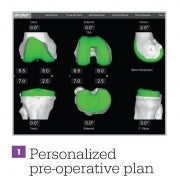 Personalized pre-operative plan